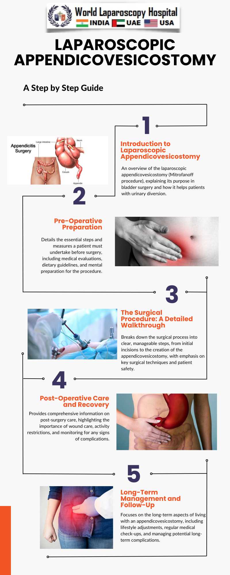 Laparoscopic Appendicovesicostomy Mastering the Mitrofanoff Procedure